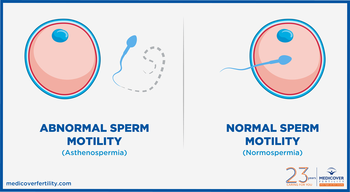 Sperm Motility Normal And Low Motility Explained Clearblue
